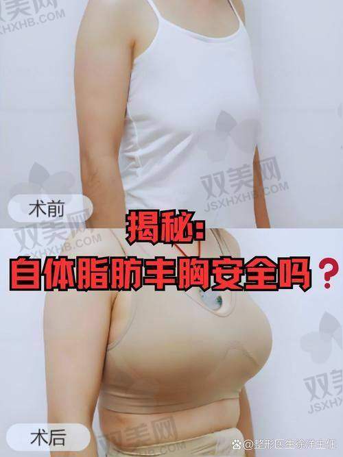 如何选择合适的医院和医生