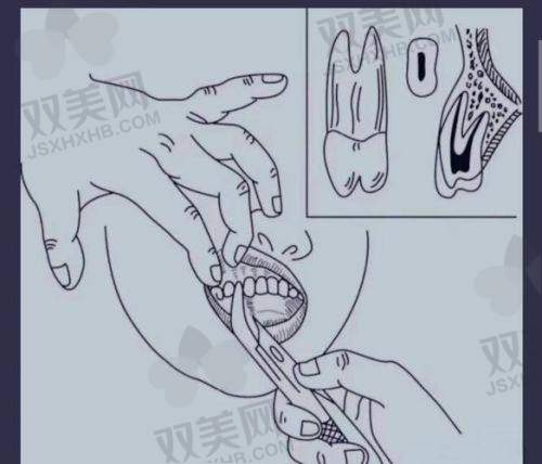 特殊情况增加成本