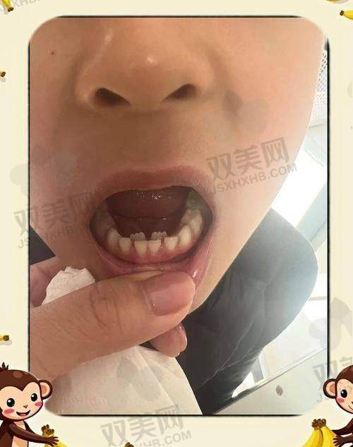 美观要求影响价格
