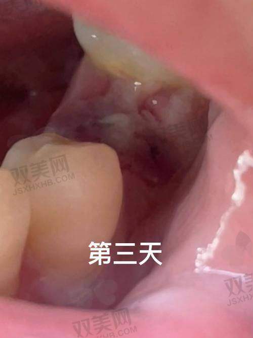 保修年限影响价格