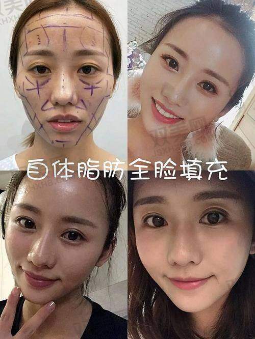 【深圳米可医疗美容诊所电话号码是多少】