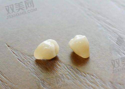 四、价格对比：迪瑞真的是“牙圈性价比典范”