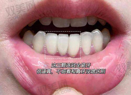 七、种草末尾一步：选对医院和医生是关键