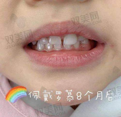 末尾总结: