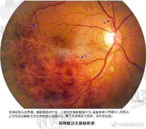 许艺民医生手术实例