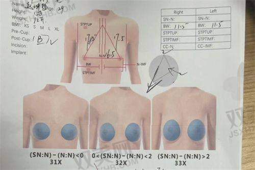 【东莞科医能医疗美容医院是正规的吗】