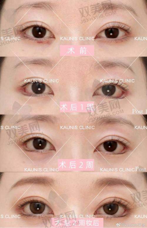 【东莞天后医疗美容医院电话号码是多少】