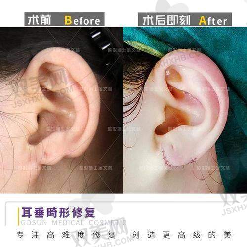 手术过程:安心又放心