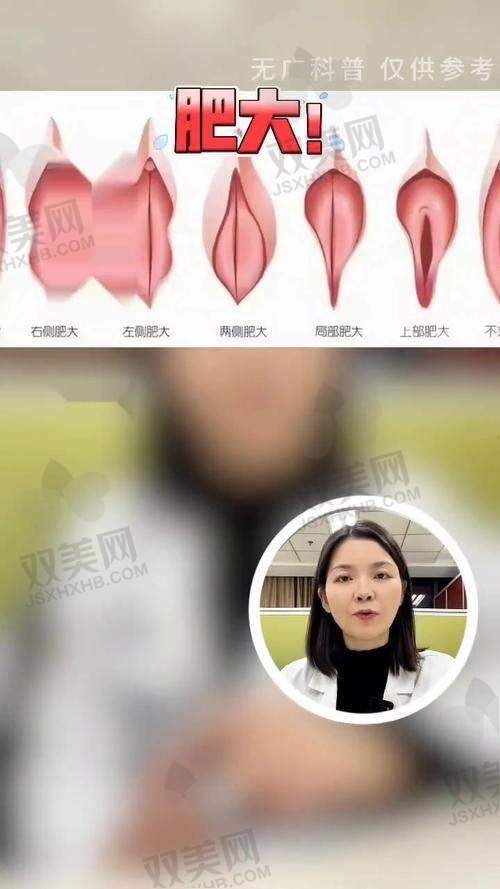 菲蜜丽激光缩阴手术费用大揭秘