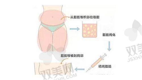 成效：眶下年轻了，疲惫感也没了