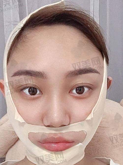 手术过程