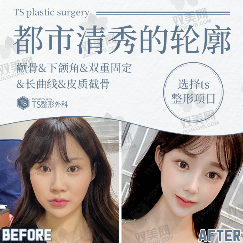 【惠州惠阳星途医疗美容门诊部擅长什么项目】
