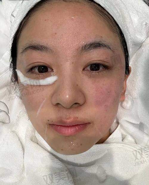 【珠海美南华医疗美容门诊部怎么预约挂号】