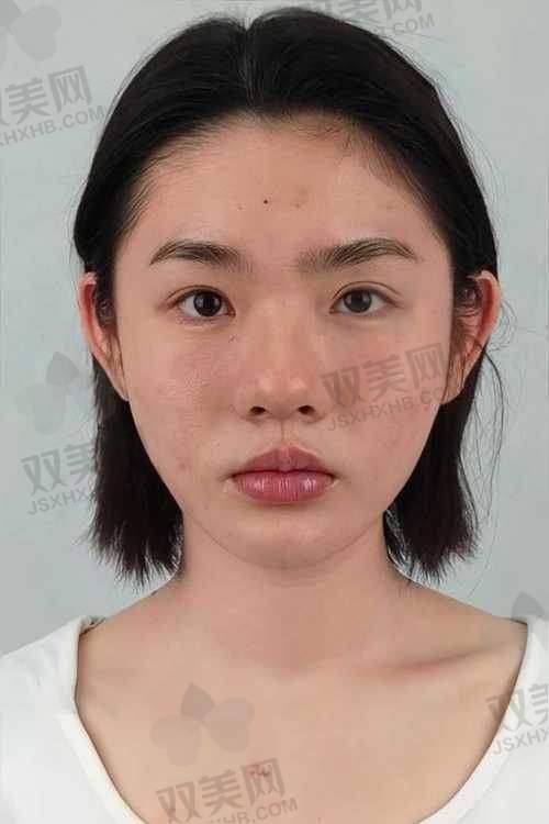 【珠海美南华医疗美容门诊部怎么样】