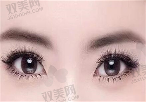 重庆美仑美奂董开云做东方原生美眼凝血技术版10800元起,效果自然创伤小