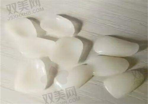 五、灵犀瓷贴面价格多少正常?别被“低价光环”洗脑