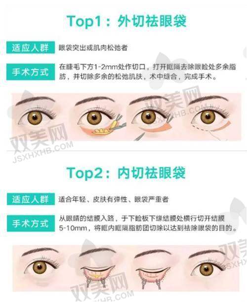 重庆美仑美奂董开云做东方原生美眼凝血技术版实例