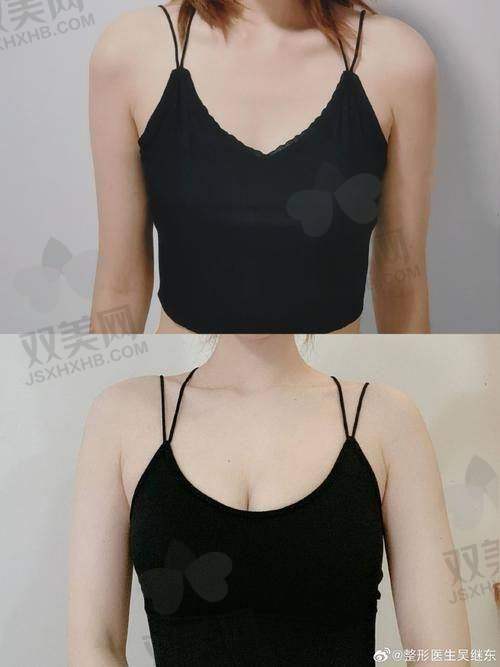 傲诺拉各型号介绍