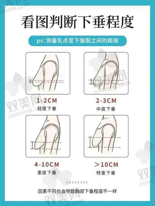 傲诺拉各系列价格揭秘