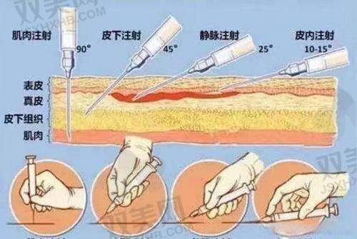 一、润蕾雅医用 I 型胶原无菌凝胶到底是啥?能干嘛?