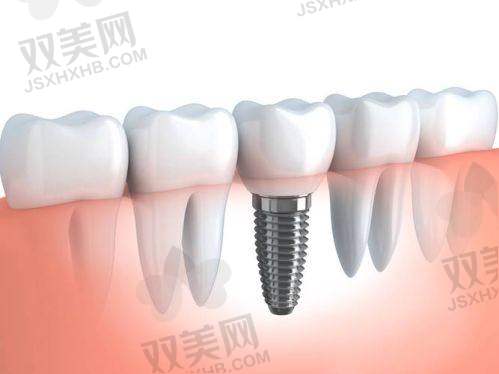【宁波海曙西门惠博口腔门诊部擅长什么项目】