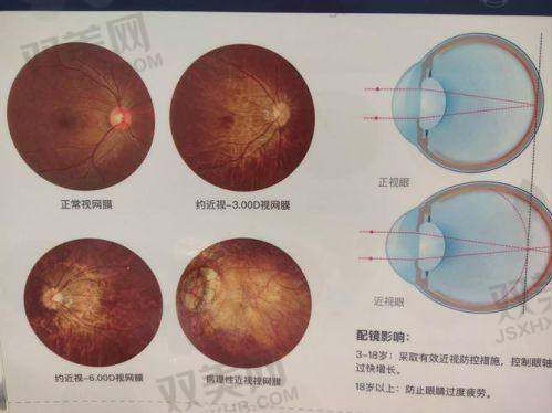 【呼和浩特市回民医院眼科营业时间是什么时候】
