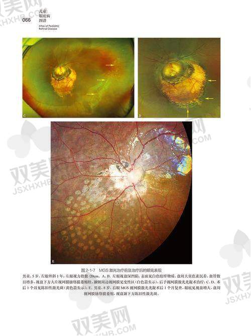 【呼和浩特市回民医院眼科电话号码是多少】