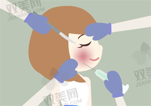 成都新丽美陈再洪医生做鼻唇沟脂肪移植术4800元起|淡化法令纹+中面部提升效果佳