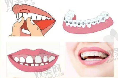 【北京瑞鲨口腔医院医生名单】