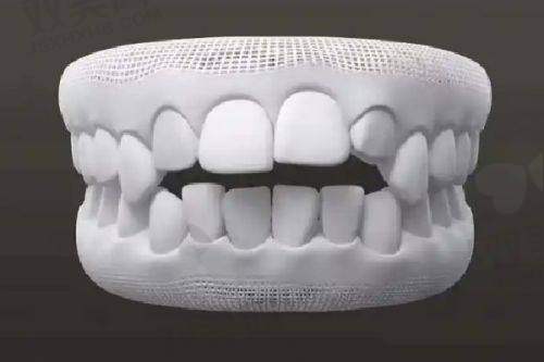 【北京京一口腔门诊部擅长什么项目】