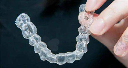 正畸摇椅弓可能存在的副作用