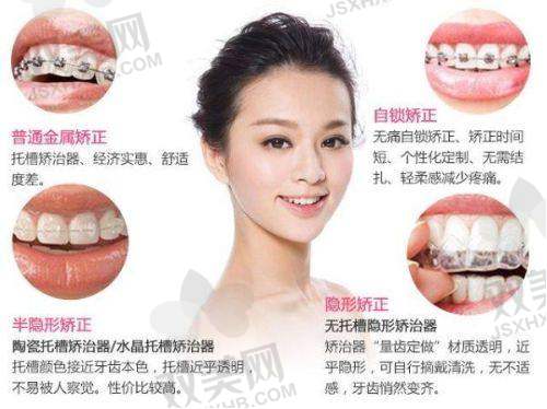 金属托槽矫正的费用