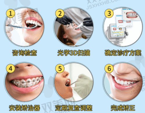 金属托槽矫正的价格分析