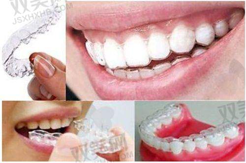 患者牙齿情况因素