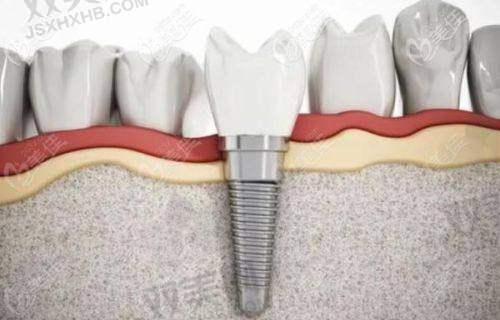 【北京通州雅仕口腔门诊部怎么样】