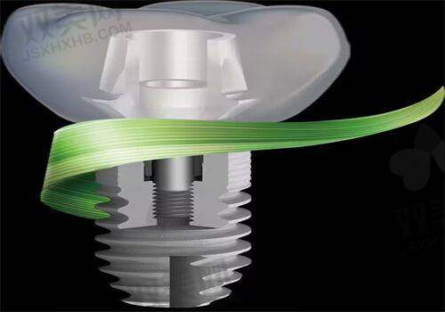 【北京维恩口腔亦庄店是正规的吗】