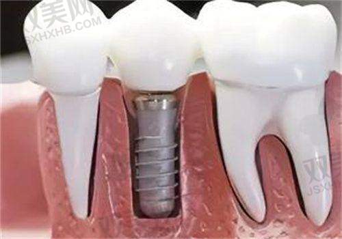 【北京昌平牙适乐口腔门诊部怎么预约挂号】