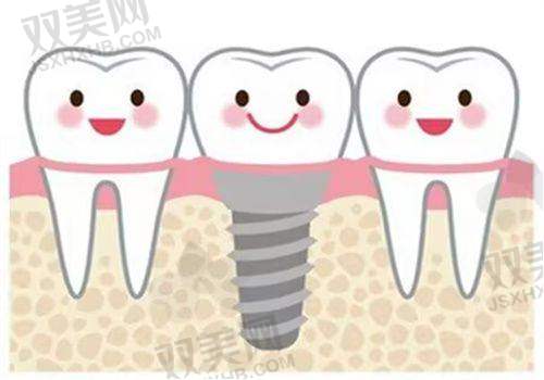 【北京维恩口腔亦庄店技术特点】