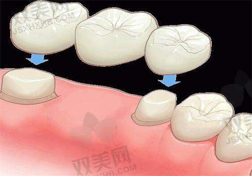 【北京维恩口腔安贞和平总院怎么样】