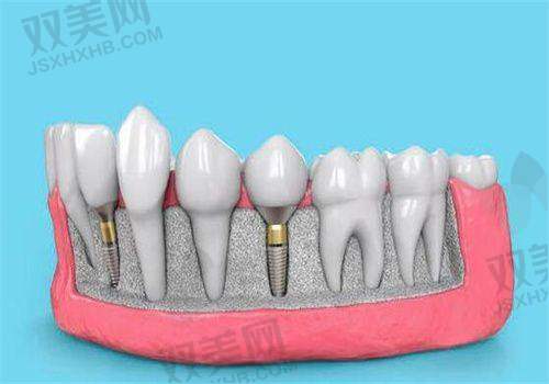 【北京倪氏口腔医院是私立还是公办】