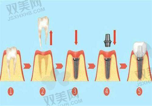 【北京维恩口腔安贞和平总院医生名单】