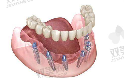【北京维恩口腔安贞和平总院怎么预约挂号】