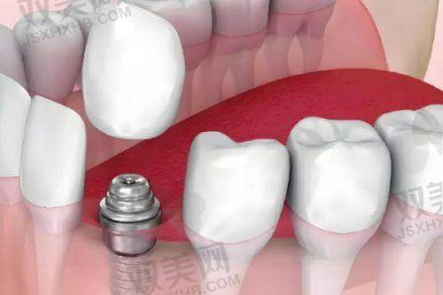 北京劲松苏州桥口腔医院价格表