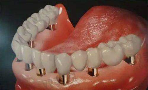 【北京维恩口腔房山店怎么预约挂号】