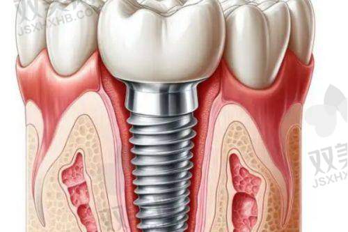【北京维恩口腔五道口店擅长什么项目】