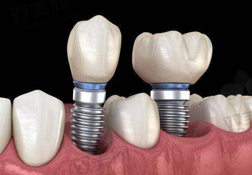 【北京维恩口腔常营店技术特点】