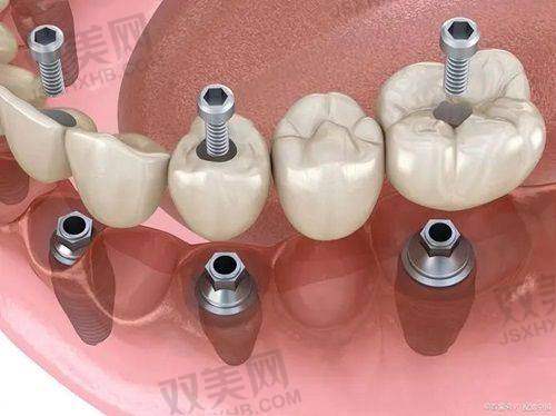 【北京维恩口腔安贞和平总院地址及乘车路线】