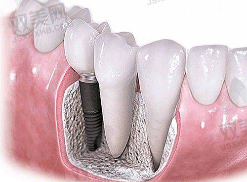 【北京维恩口腔五道口店营业时间是什么时候】