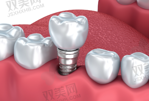 【北京维恩口腔安贞和平总院技术特点】