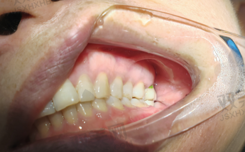 【北京维恩口腔房山店擅长什么项目】